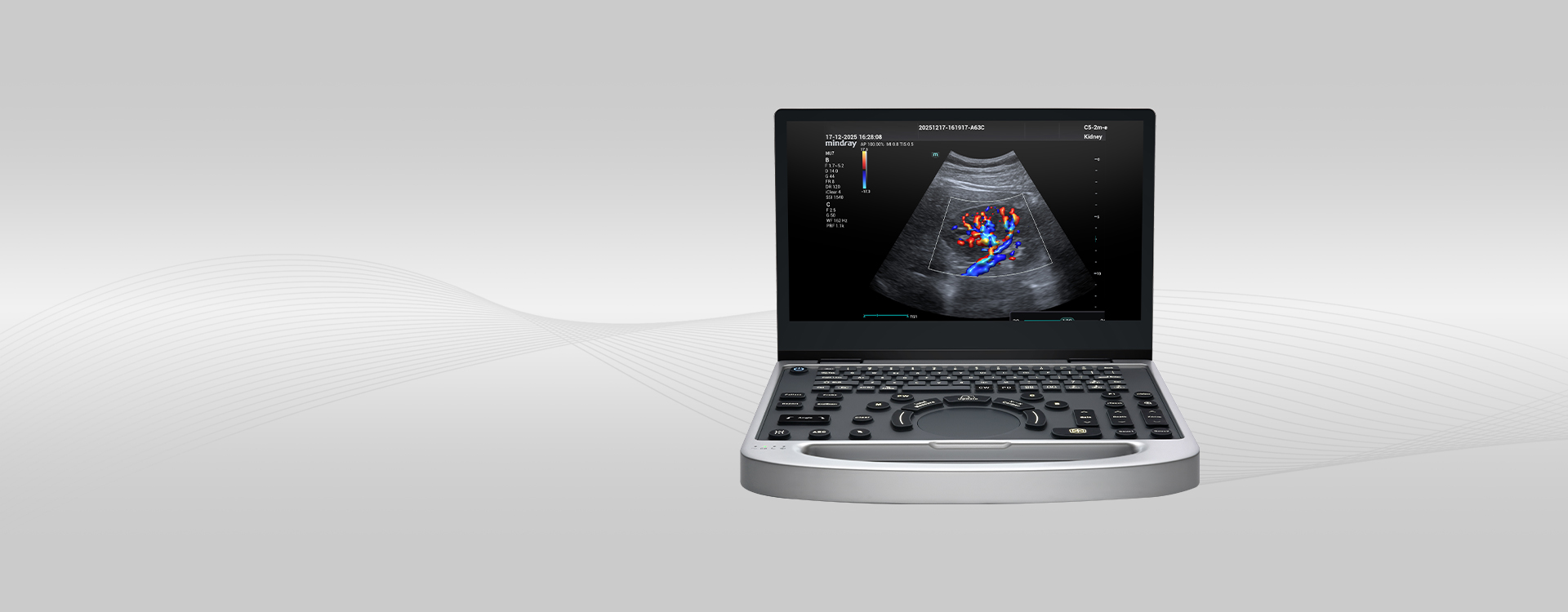 Mindray MU7 Diagnostic Ultrasound System