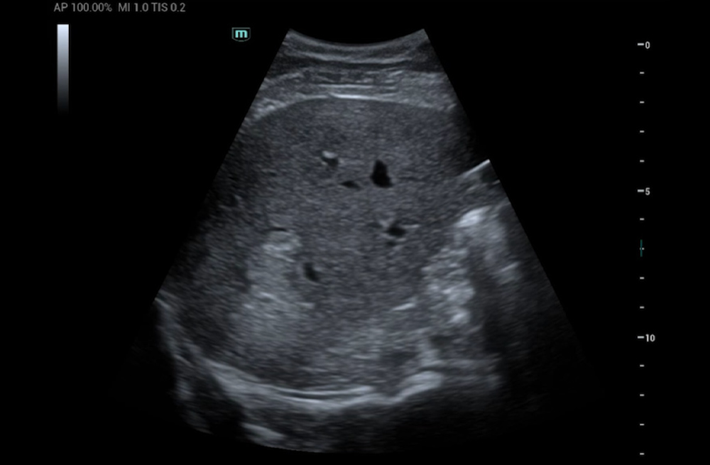 Mindray MU9 – Diagnostic Ultrasound System - Image 10