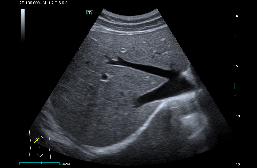 Mindray MU9 – Diagnostic Ultrasound System - Image 16