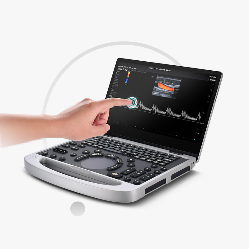 Mindray MU9 – Diagnostic Ultrasound System - Image 13