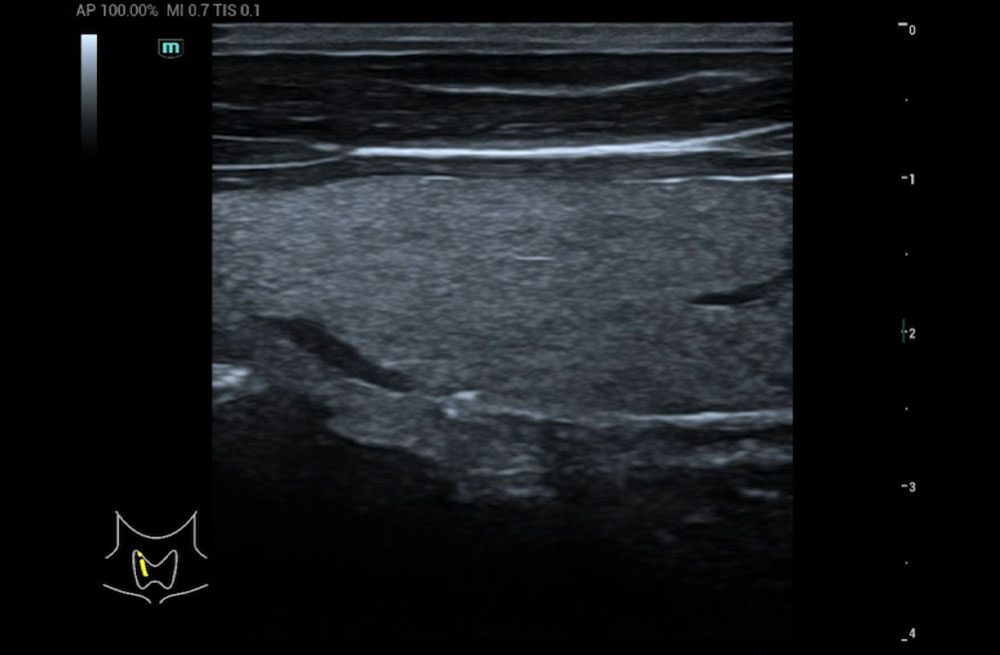 Mindray MU7 – Diagnostic Ultrasound System - Image 10