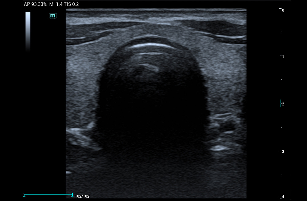 Mindray MU9 – Diagnostic Ultrasound System - Image 12