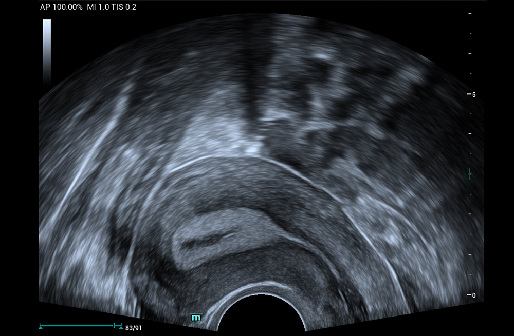 Mindray MU9 – Diagnostic Ultrasound System - Image 9