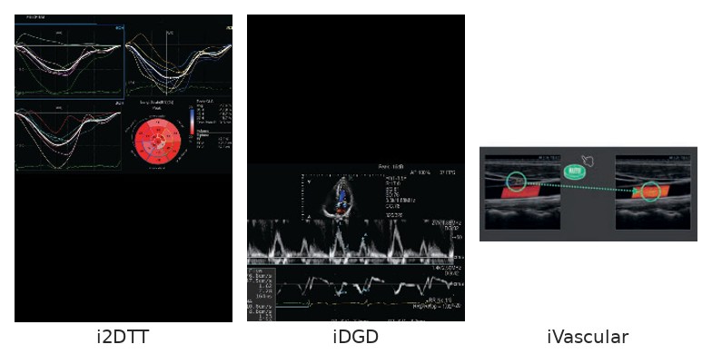 Καρδιαγγειακά: i2DTT, iDGD, iVascular