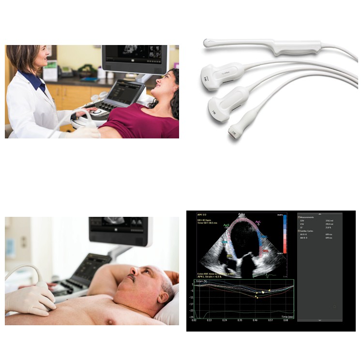 Δείγματα κλινικής απεικόνισης – Philips Affiniti 70